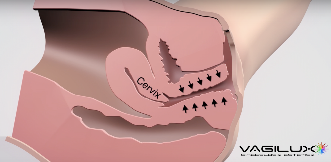 Efectividad desde la Primera Sesión