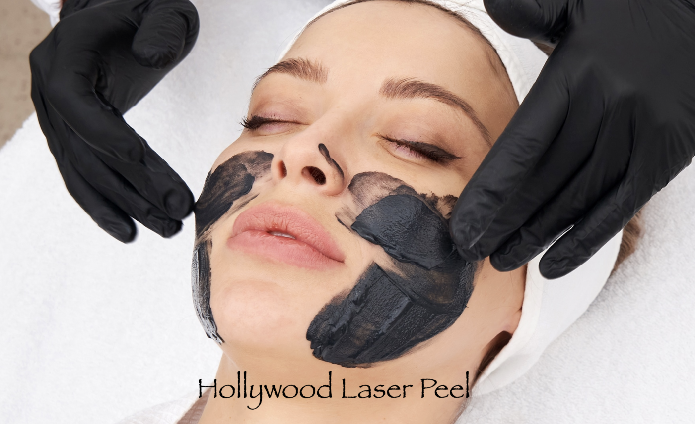 Hollywood Laser Peel