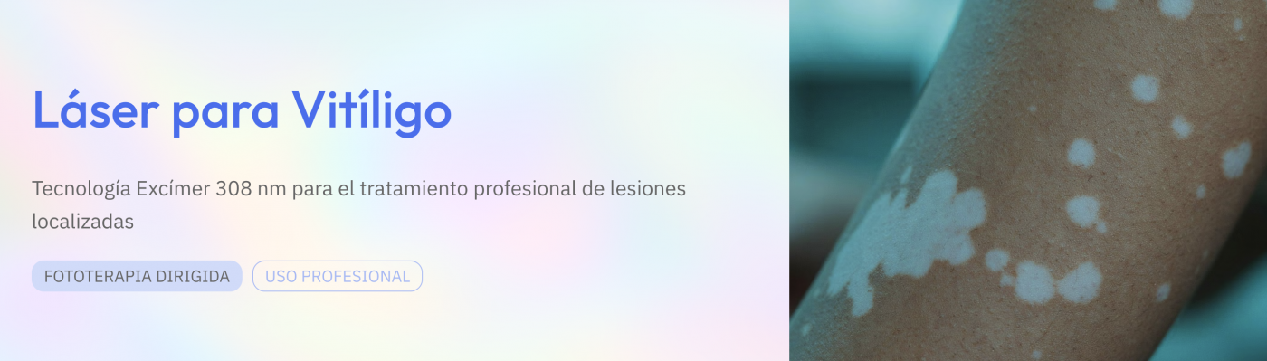 láser para vitíligo